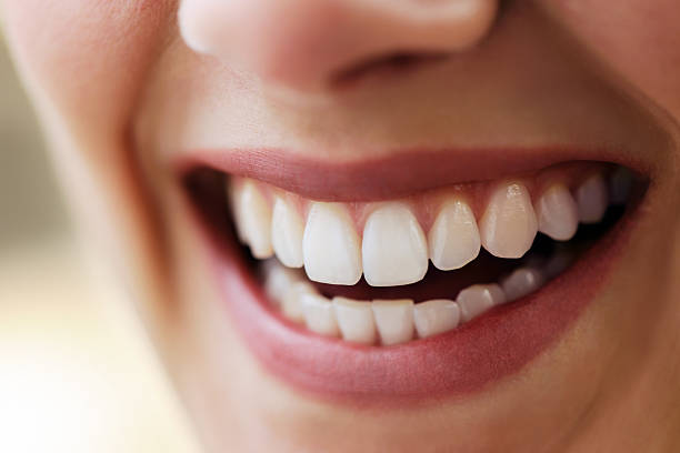 Sonrisa Gingival en Valencia
